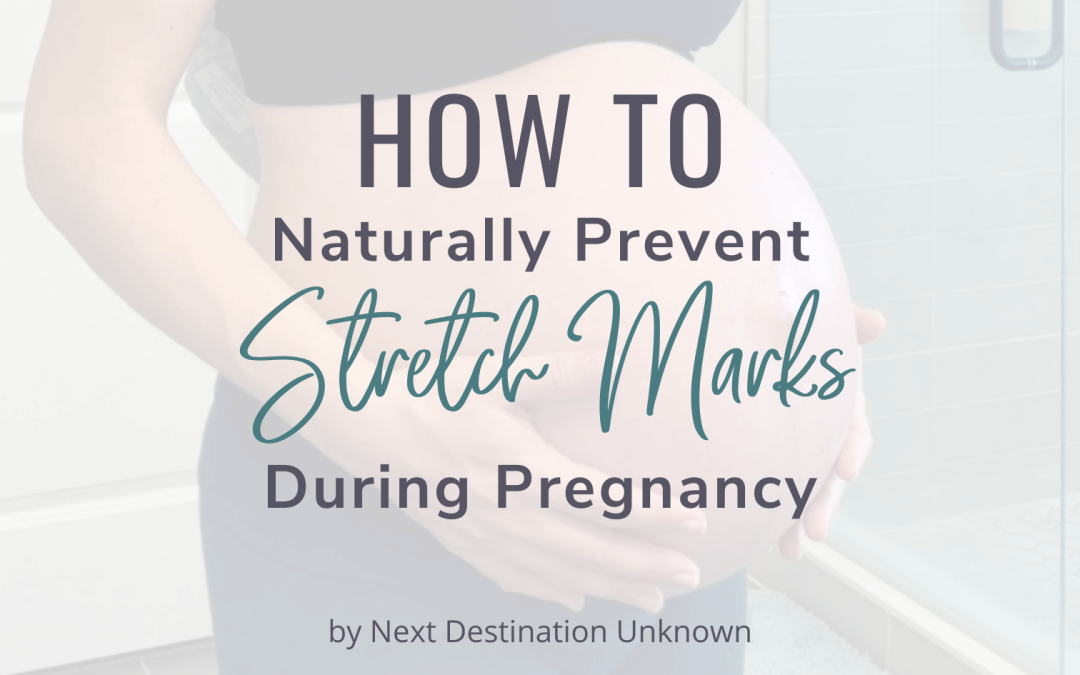 4 Easy Ways For How To Prevent Stretch Marks Naturally During Pregnancy