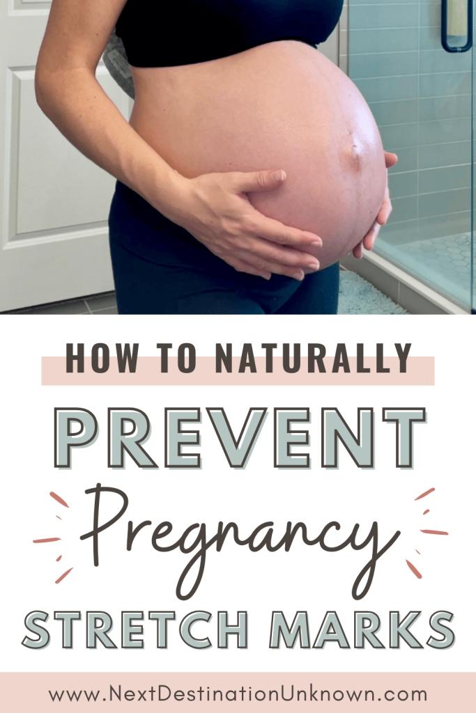 How To Prevent Stretch Marks When Pregnant